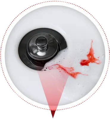 Bleeding in the sink when brushing teeth