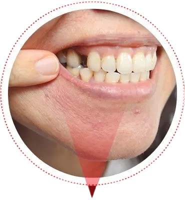 Person showing loose teeth